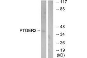 Western blot analysis of extracts from HeLa cells, using PTGER2 Antibody. (PTGER2 抗体  (AA 260-309))
