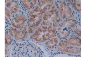 DAB staining on IHC-P; Samples: Human Kidney Tissue (SIVA1 抗体  (AA 1-175))