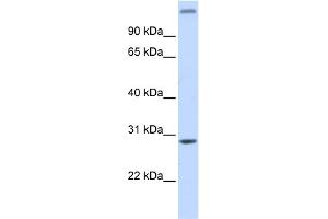 WB Suggested Anti-ALKBH2 Antibody Titration: 0. (ALKBH2 抗体  (Middle Region))