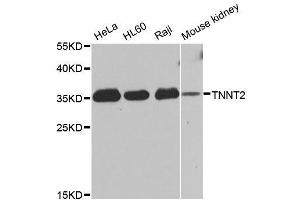Western blot analysis of extracts of various cell lines, using TNNT2 antibody. (Cardiac Troponin T2 抗体  (AA 1-120))