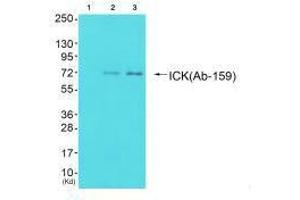 Western blot analysis of extracts from 293 cells (Lane 2) and cos-7 cells (Lane 3), using ICK (Ab-159) antiobdy. (ICK 抗体  (Tyr159))