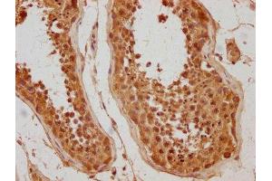 IHC image of ABIN7175810 diluted at 1:500 and staining in paraffin-embedded human testis tissue performed on a Leica BondTM system. (WDR92 抗体  (AA 122-357))