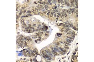 Immunohistochemistry of paraffin-embedded human colon using UFD1L antibody (ABIN6291036) at dilution of 1:100 (40x lens). (UFD1L 抗体)