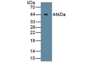 Detection of Recombinant C9, Rabbit using Polyclonal Antibody to Complement Component 9 (C9) (C9 抗体  (AA 139-519))