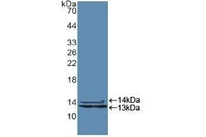 Detection of Recombinant HNRPA2B1, Human using Polyclonal Antibody to Heterogeneous Nuclear Ribonucleoprotein A2/B1 (HNRPA2B1) (HNRNPA2B1 抗体  (AA 21-103))