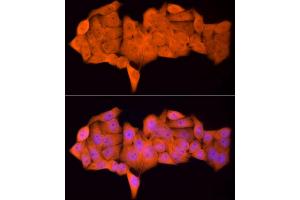Immunofluorescence analysis of HeLa cells using PSMC5 Rabbit mAb (ABIN7269585) at dilution of 1:50 (40x lens). (PSMC5 抗体)