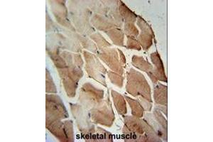 ACOT11 Antibody (C-term) immunohistochemistry analysis in formalin fixed and paraffin embedded human skeletal muscle followed by peroxidase conjugation of the secondary antibody and DAB staining. (ACOT11 抗体  (C-Term))