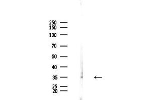 anti-Ubiquitin Protein Ligase E3 Component N-Recognin 1 (UBR1) (Internal Region) antibody