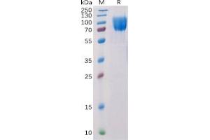Human CD117 Protein, His Tag on SDS-PAGE under reducing condition. (KIT Protein (His tag))