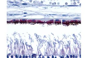 Anti-RRH / Peropsin antibody IHC of human eye, pigmented retinal epithelium. (Peropsin 抗体  (Cytoplasmic Domain))