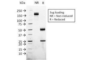 SDS-PAGE (SDS) image for anti-Glypican 3 (GPC3) (AA 511-580) antibody (ABIN6939523)