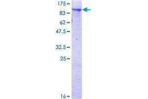 RINT1 Protein (AA 1-792) (GST tag)