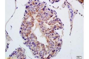 Formalin-fixed and paraffin embedded rat testis labeled with Anti-TXNRD1 Polyclonal Antibody, Unconjugated (ABIN1386102) at 1:200 followed by conjugation to the secondary antibody and DAB staining (TXNRD1 抗体  (AA 451-550))