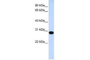 Western Blot showing DRGX antibody used at a concentration of 1-2 ug/ml to detect its target protein. (DRGX 抗体  (Middle Region))