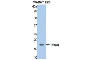 Detection of Recombinant CALR, Human using Polyclonal Antibody to Calreticulin (CALR) (Calreticulin 抗体  (AA 196-310))