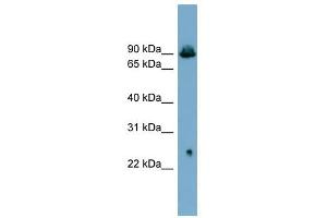 SLC6A5 antibody used at 1 ug/ml to detect target protein. (SLC6A5 抗体)