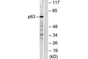 Western blot analysis of extracts from COS7 cells, using p63 Antibody. (TCP1 alpha/CCTA 抗体  (AA 631-680))