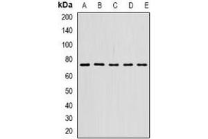 Western blot analysis of STS-1 expression in SW620 (A), SKOV3 (B), mouse spleen (C), mouse lung (D), rat brain (E) whole cell lysates. (UBASH3B 抗体)