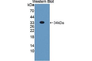Detection of Recombinant STX2, Human using Polyclonal Antibody to Syntaxin 2 (STX2) (STX2 抗体  (AA 8-262))