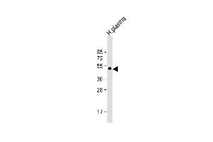 Anti-PROC Antibody at 1:1000 dilution + H. (PROC 抗体)