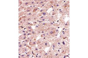 Immunohistochemical analysis of paraffin-embedded H. (MATN2 抗体  (AA 732-760))