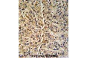 Immunohistochemistry (IHC) image for anti-Glucosamine (N-Acetyl)-6-Sulfatase (GNS) antibody (ABIN3002692) (GNS 抗体)
