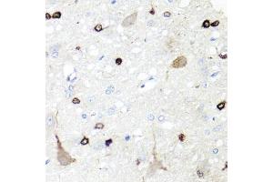 Immunohistochemistry of paraffin-embedded rat brain using IGFBP5 antibody. (IGFBP5 抗体)