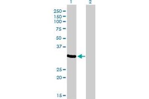 Western Blot analysis of ZNF215 expression in transfected 293T cell line by ZNF215 monoclonal antibody (M01), clone 2C11. (ZNF215 抗体  (AA 1-304))
