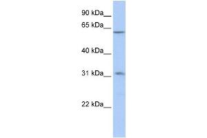 WB Suggested Anti-ZNF677 Antibody Titration:  0. (ZNF677 抗体  (C-Term))