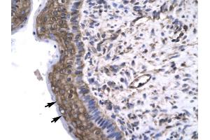 Human Spermatophore; Rabbit Anti-GTF2F2 Antibody. (GTF2F2 抗体  (Middle Region))