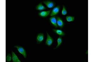Immunofluorescence staining of A549 cells with ABIN7143827 at 1:66, counter-stained with DAPI. (alpha Actinin 4 抗体  (AA 160-440))