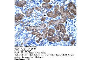 Human kidney (TRIM31 抗体  (N-Term))