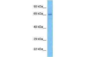 Host:  Rabbit  Target Name:  ZN273  Sample Type:  786-0 Whole Cell lysates  Antibody Dilution:  1.