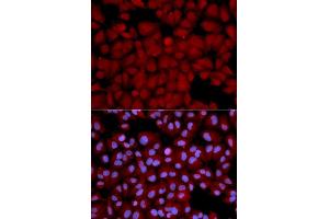 Immunofluorescence analysis of U2OS cells using PPP1CB antibody (ABIN5970446). (PPP1CB 抗体)