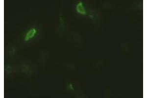 Anti-EpCAM mouse monoclonal antibody (ABIN2452362) immunofluorescent staining of HeLa cells transiently transfected by pCMV6-ENTRY EpCAM (RC201989) (EpCAM 抗体  (AA 24-265))
