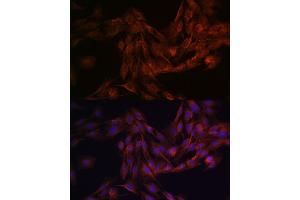 Immunofluorescence (IF) image for anti-Glutamate Receptor, Ionotropic, N-Methyl D-Aspartate 1 (GRIN1) (AA 600-700) antibody (ABIN6141400)