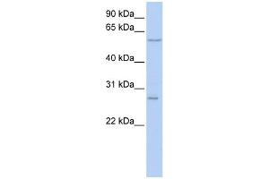 WB Suggested Anti-NETO2 Antibody Titration:  0.