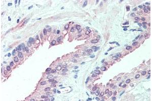 Anti-SLITRK6 antibody  ABIN960816 IHC staining of human prostate. (SLITRK6 抗体  (Internal Region))