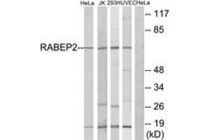 Western blot analysis of extracts from HeLa/Jurkat/293/HuvEc cells, using RABEP2 Antibody. (RABEP2 抗体  (AA 353-402))