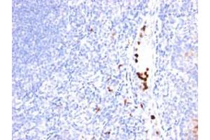 Immunohistochemical staining (Formalin-fixed paraffin-embedded sections) of human tonsil with MYADM monoclonal antibody, clone MYADM/971 .