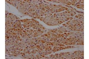IHC image of ABIN7127803 diluted at 1:100 and staining in paraffin-embedded human heart tissue performed on a Leica BondTM system. (Recombinant SDHB 抗体)