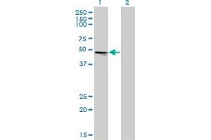 Western Blot analysis of VRK1 expression in transfected 293T cell line by VRK1 monoclonal antibody (M02), clone 4F9. (VRK1 抗体  (AA 287-396))