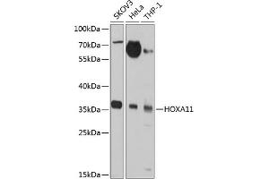 Western blot analysis of extracts of various cell lines, using HOX antibody (ABIN3017106, ABIN3017107, ABIN1680330 and ABIN6219956) at 1:1000 dilution. (Homeobox A11 抗体  (AA 1-180))