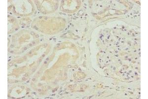 Immunohistochemistry of paraffin-embedded human kidney tissue using ABIN7170087 at dilution of 1:100 (SLC12A6 抗体  (AA 60-190))