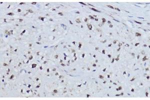 Immunohistochemistry of paraffin-embedded Human uterus using ESRRA Polyclonal Antibody at dilution of 1:200 (40x lens). (ESRRA 抗体)