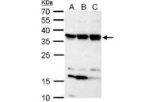 WB Image C11orf54 antibody detects C11orf54 protein by Western blot analysis. (C11orf54 抗体)