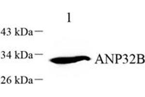 ANP32B 抗体