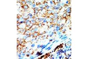 Image no. 1 for anti-NME/NM23 Nucleoside Diphosphate Kinase 4 (NME4) (C-Term) antibody (ABIN360669) (NME4 抗体  (C-Term))