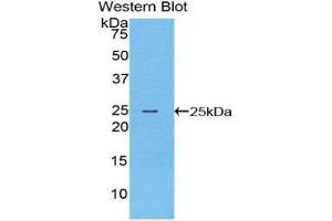 Western Blotting (WB) image for anti-Filaggrin (FLG) (AA 3905-4031) antibody (ABIN1078038) (Filaggrin 抗体  (AA 3905-4031))