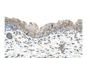 Ribophorin II antibody was used for immunohistochemistry at a concentration of 4-8 ug/ml to stain Squamous epithelial cells (arrows) in Human Skin. (Ribophorin II 抗体  (N-Term))